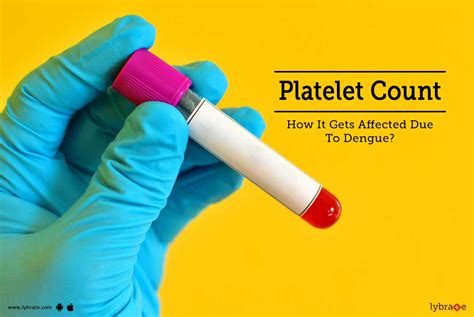 When to check platelet dengue dr mata